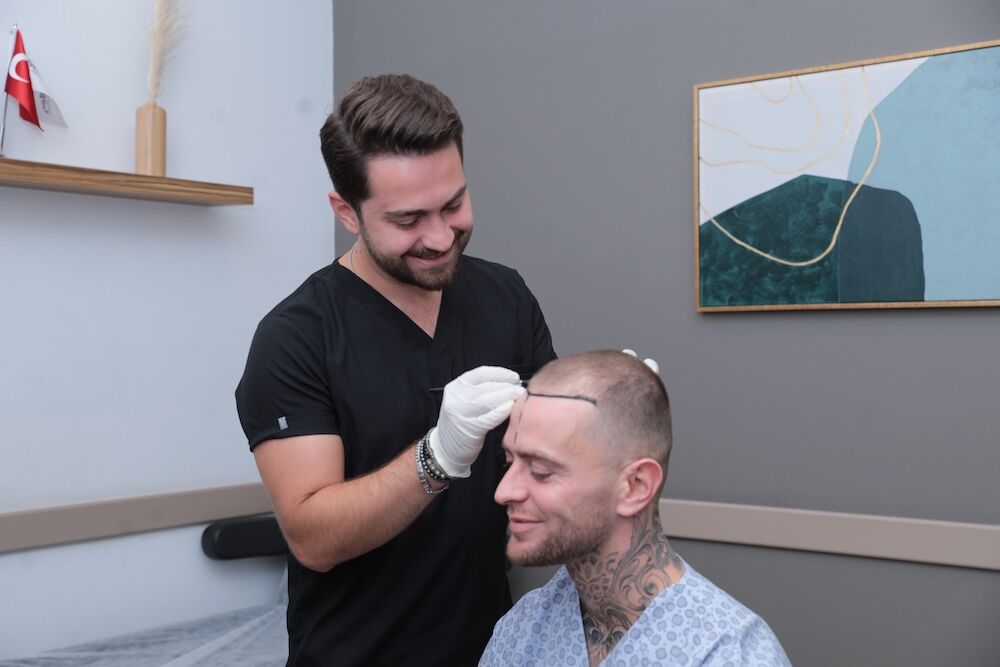 Hair Transplant Plan