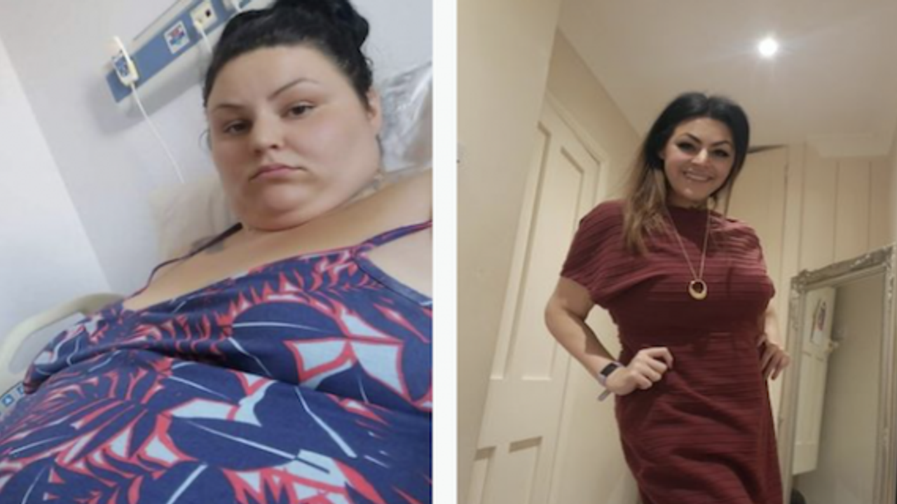 Rebecca Wilkinson flew to Turkey to have surgery that she says changed her life ! Psychic predicted she'd 'die' without drastic action