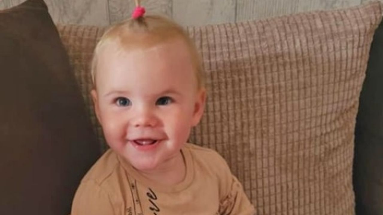 A 2 year-old boy injured by a dog bite earlier this week has died, British police said