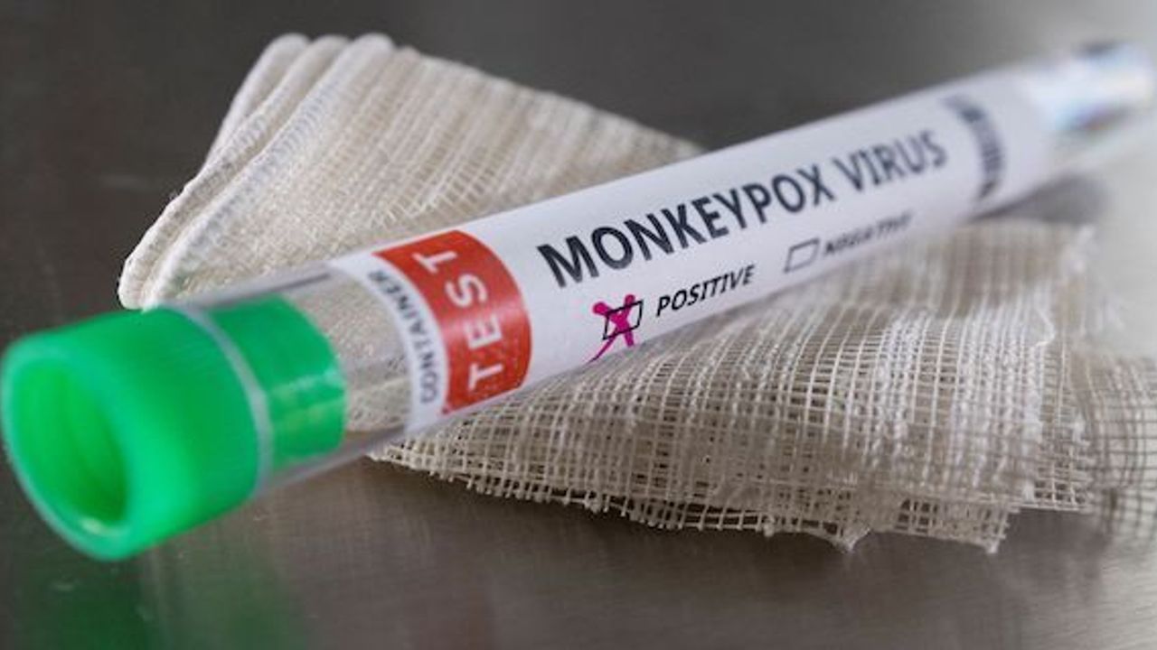 Doctors in England will have to notify their local council if they suspect patient has virus